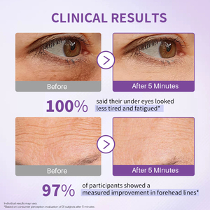 Gel Contour des Yeux Anti-Rides Effet Lifting Instantané OEM Marque Privée | Correcteur Anti-Poches et Anti-Cernes en 5 Minutes | Crème Traitement Anti-Âge pour les Yeux - Product Image 5