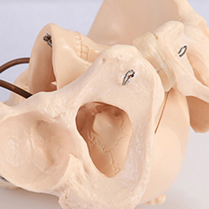 Modèle anatomique <span class=keywords><strong>du</strong></span> bassin féminin avec crâne fœtal, modèle osseux de gynécologie A1038 - Product Image 5