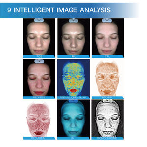 Analyseur de peau Pro-A avec stockage VIP sur le cloud, stylo de détection d'hydratation 5 spectres, outil d'analyse faciale à usage commercial ZA - Product Image 4