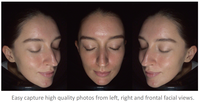 Analyseur d'image de la peau du visage 3D Meicet de haute qualité pour les salons de beauté et les cliniques