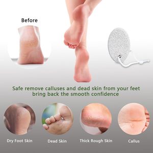 Pierre ponce 100% naturelle en pierre de lave pour le corps et les pieds, avec corde en coton pour application sur les jambes - Product Image 3