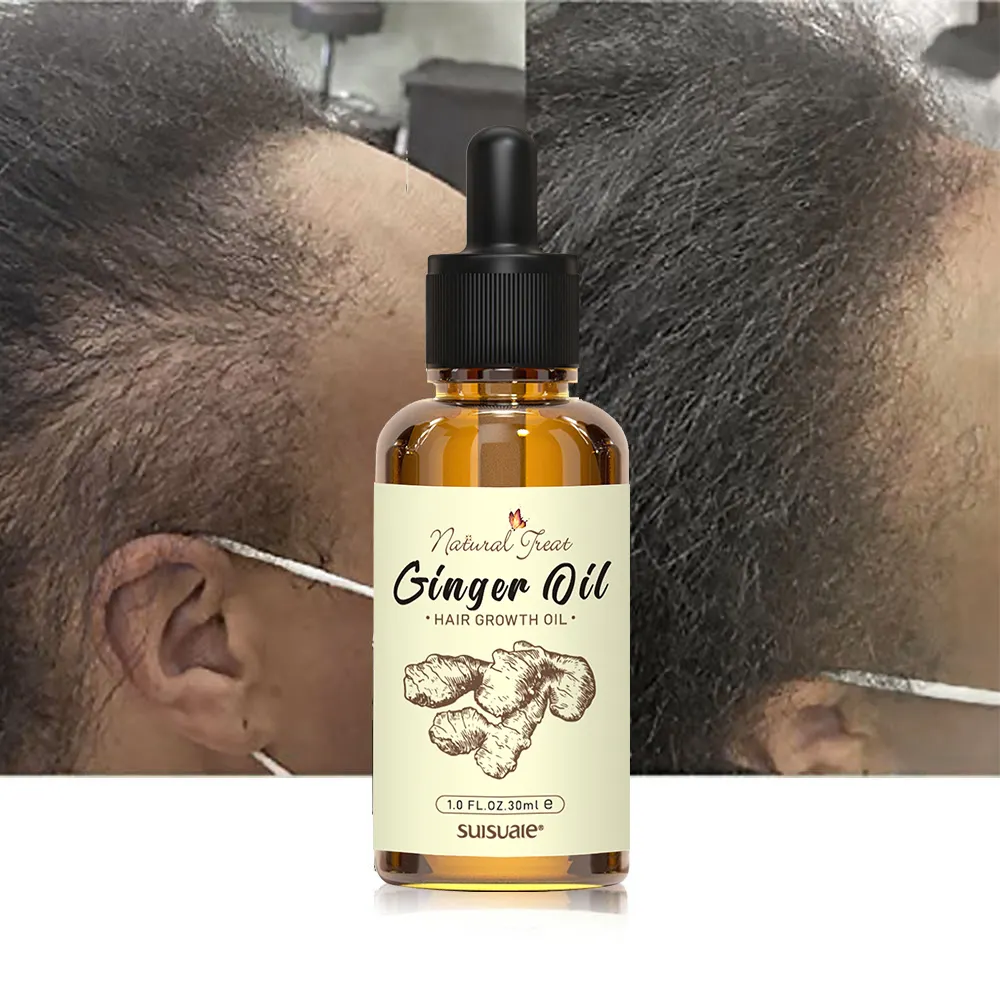 Custom Logo Scalp Care Products 100% Pure Fast Organic Hair Care Treatment Ginger Hair Growth Oil