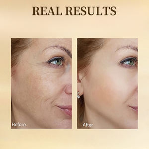 Sérum de taches sombres de ginseng d'or 24 carats de marque privée huile essentielle de racine de ginseng resserrer l'hydratation anti-âge avec du polypeptide - Product Image 3