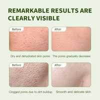 Sérum Visage à la Vitamine C Apaisant et Hydratant, Réparateur de Barrière Cutanée, à l'Extrait Végétal de Cactus, Essence Affinante des Pores – Fournisseur OEM