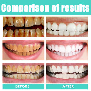 Enjuague Bucal Blanqueador de Dientes Sin Alcohol de Alta Calidad, 100 ml, con Vitamina E, Cuidado Bucal, Boca Más Saludable, para el Hogar, Hotel, Viajes y Spa - Product Image 4