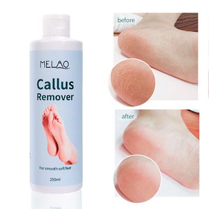 Exfoliante de Marca Privada, Gel Hidratante, Lima de Pies Colosal, Removedor de <span class=keywords><strong>Callos</strong></span>, <span class=keywords><strong>Crema</strong></span> Exfoliante <span class=keywords><strong>para</strong></span> Pies con Talones Agrietados - Product Image 6
