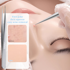 Pince à épiler extractrice de points noirs et de boutons en acier inoxydable de haute qualité, ultra-fine, pour le visage - Product Image 3