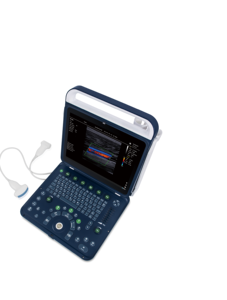 Máquina de Ultrassom Veterinário BMV BPU60C Baseada em Linux com Imagem Colorida Doppler 3D/4D e Monitor LED de 15 polegadas Recarregável via USB CE - Product Image 4