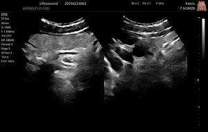 Escáner de Ultrasonido Veterinario Portátil Digital 3D con Doppler Color, Ecógrafo Doppler Color, Ultrasonido Veterinario - Product Image 3