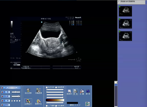 Repair <b>ultrasound</b> reporting software for creating and sharing professional <b>ultrasound</b> reports Hospital software ViewPoint 6 - Product Image 4