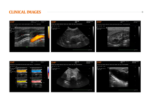 Appareil d'échographie portable noir et <span class=keywords><strong>blanc</strong></span> MR-N5 pour animaux de compagnie (chats, chiens, vaches) pour clinique vétérinaire - Product Image 3