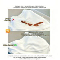 YUPINXI 5-in-1 Gel Pencuci Pakaian Ramah Lingkungan untuk Kebersihan Rumah Tangga & Penghilang Noda Aroma Tahan Lama Tidak Mengiritasi Tangan