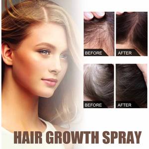 OEM West <span class=keywords><strong>Month</strong></span> <span class=keywords><strong>Hair</strong></span> Root <span class=keywords><strong>Growth</strong></span> Anti Dropping Masaje de cabello firme Tratamientos de crecimiento de cabello denso del cuero cabelludo - Product Image 5