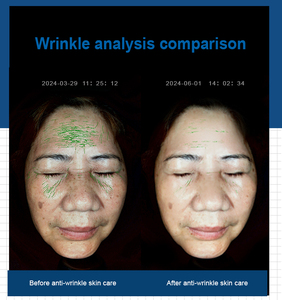 Hot Sale 3D Digital Skin Analyzer Magic Mirror Facial Scanner with AI Intelligence Detection WiFi Enabled for Commercial Use - Product Image 4