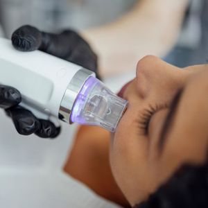 Chất lượng cao đa chức năng máy 808nm Nd Yag <span class=keywords><strong>RF</strong></span> microneedles Diode Laser loại bỏ hình xăm tóc loại bỏ 3in1 máy laser - Product Image 5