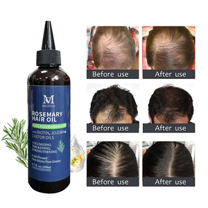Großhandel 200ml Rosmarin-Haaröl zur Kopfhaut-Regeneration und Haarvitalisierung, Pflanzliche Pflege für Haarwachstum, Frisches Rosmarin-Haarwuchsöl für den Heimgebrauch - Product Image 1