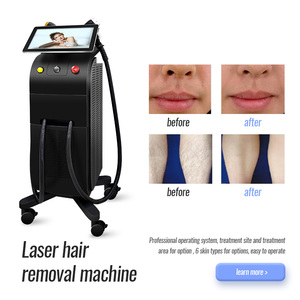 Dispositivo de Depilación Láser de Diodo 2026, Gran Venta, para Salones de Belleza y Spas - Product Image 4
