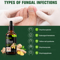Sérum de Traitement des Ongles au Gingembre 60ml Marque Privée OEM ODM – Réparation Rapide en 7 Jours pour Ongles Jaunes, Épais, Cassants et Soin Antifongique des Ongles des Pieds