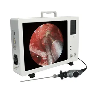 集成便携式内窥镜摄像单元1080P用于耳鼻喉科
