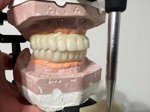 Vsmile Vita 16 tonalità candeggina A1/A2/A3 Cad Cam materiali di fresatura dentale Pmma Block multistrato Pmma Disc10-25mm