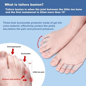 Attelle en gel pour <span class=keywords><strong>petit</strong></span> orteil, correcteur d'hallux valgus – Confort durable et respirant pour soulager la douleur des orteils superposés, protection contre les ampoules et les cors, transparente - Product Image 4
