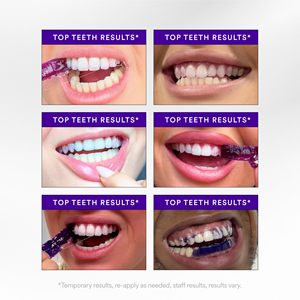 Hot Selling Custom Logo Packaging Non Peroxide <strong>Premium</strong> Residue Free GlorySmile V34 Purple <strong>Teeth</strong> <strong>Whitening</strong> <strong>Strips</strong> - Product Image 2
