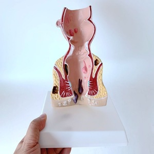 Menselijk Colorectaal Model Rectaal Pathologisch Aambei Model Anale Fistel Anatomisch Model - Product Image 2