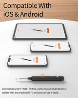 Bebird Xlife X1+ Nettoyeur d'oreilles électrique avec caméra, kit otoscope visuel, WiFi, intelligent et portable