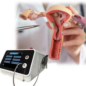Tratamiento Ginecológico de Rejuvenecimiento <span class=keywords><strong>Vaginal</strong></span> con Láser LVR, Cirugía con Láser de Fibra Endovenosa de 980nm y 1470nm para la Laxitud y Sequedad <span class=keywords><strong>Vaginal</strong></span>, Láser Ginecológico - Product Image 3