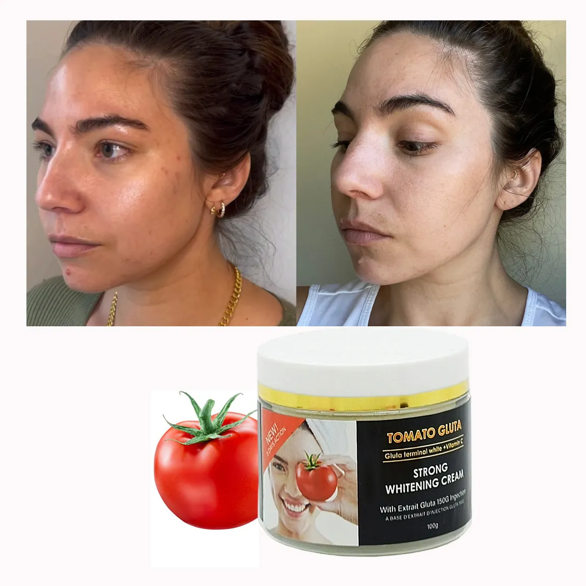 Etiqueta privada Crema blanqueadora Cara Tomate Gluta Removedor de manchas oscuras Sin efectos secundarios Crema facial blanqueadora de la piel