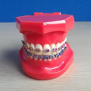 牙科支架高品质可粘合单块支架罗斯/MBT牙齿正畸支架迷你精英支架 (罗斯 *)