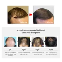 PURC विरोधी बालों के झड़ने उपचार कार्बनिक अदरक बाल विकास तेल निजी लेबल प्राकृतिक बढ़ने बालों की देखभाल के लिए विकास सीरम पुरुषों महिलाओं