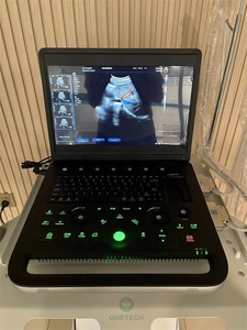 C10 rumah sakit portabel warna doppler ecograph Harga terbaik 3D portabel warna Doppler <span class=keywords><strong>ultrasound</strong></span> - Product Image 6