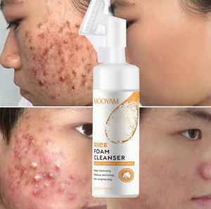 MOOYAM OEM Arroz Espuma <span class=keywords><strong>Facial</strong></span> 150ml Extracto de Arroz <span class=keywords><strong>Natural</strong></span> Limpia Suavemente La Piel Opaca - Product Image 1