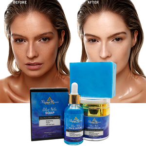 Productos para el cuidado de la piel facial con logotipo personalizado OEM, crema blanqueadora para la piel, eliminación de manchas oscuras, suero, jabón Nila, juego para el cuidado de la piel para mujeres negras - Product Image 1