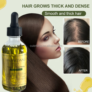 Aceites Herbales de Primera Calidad <span class=keywords><strong>para</strong></span> <span class=keywords><strong>el</strong></span> Crecimiento del <span class=keywords><strong>Cabello</strong></span>, Marca Privada, Venta al por Mayor, 100% Naturales y Orgánicos, Aceite de Romero <span class=keywords><strong>para</strong></span> <span class=keywords><strong>el</strong></span> Crecimiento del <span class=keywords><strong>Cabello</strong></span> <span class=keywords><strong>para</strong></span> Hombres - Product Image 4