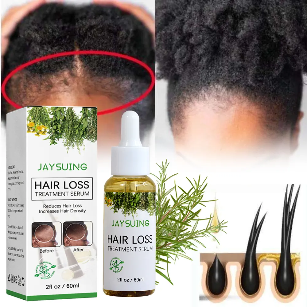 Aromlife marca própria produto de óleo de crescimento de cabelo de alecrim para mulheres negras soro essencial orgânico tratamento rosa maria selvagem b