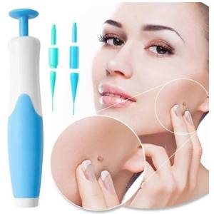 Safety 2 in 1 <strong>Skin</strong> <strong>Tag</strong> Removal Kit <strong>Skin</strong> Mole Wart <strong>Remover</strong> 2mm to 8mm <strong>Skin</strong> <strong>Tag</strong> <strong>Remover</strong> Pen With Cleansing Swabs and Repair <strong>Patch</strong> - Product Image 1