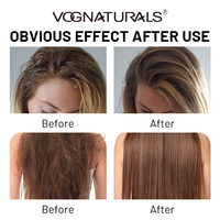 Sampo Pertumbuhan Rambut Sel Punca Alami OEM Biotin Keratin untuk Rambut Lebih Tebal Anti-Rontok Sampo Kondisioner Sel Punca Tumbuhan