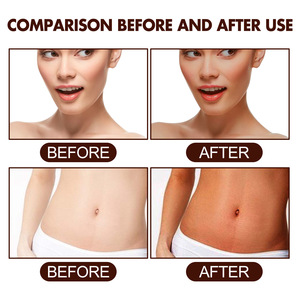 Crema Autobronceadora Corporal, Bronceado Rápido, Protección Solar para Playa y Solárium, <span class=keywords><strong>Bronceador</strong></span> Facial, Acelerador de Bronceado - Product Image 4