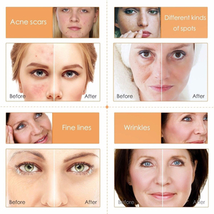 Soin De Visage La Peau Kit Perawatan Kulit, Perlengkapan Perawatan Kulit Pemutih Pelembab Pencerah Vitamin C - Product Image 5