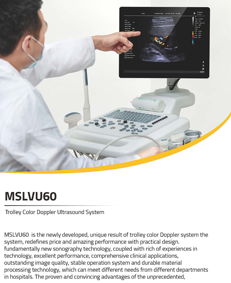 Máquina de ultrasonido Doppler en color para diagnóstico médico con diseño nuevo de 2022