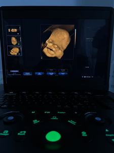 Échographe Doppler <span class=keywords><strong>Panoramique</strong></span> Couleur 2D/<span class=keywords><strong>3D</strong></span> en Temps Réel à <span class=keywords><strong>Prix</strong></span> d'Usine, Appareil Ultrasonore Numérique Complet - Product Image 6