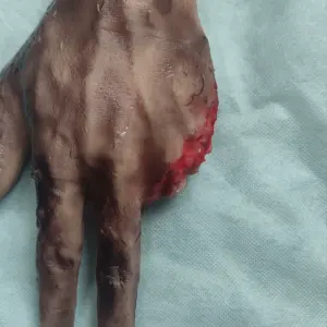 キレンメッド上肢の外傷とナイフ傷の切断モデル銃創の負傷は、縫合と切開手順を火傷します - Product Image 4