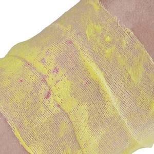 Pansement de pétrolatum Xeroform pour plaies avancées/Carton de gaze de pétrolatum stérile xéroforme Silicone CE <span class=keywords><strong>Kit</strong></span> de traumatologie infrarouge lointain 3 ans - Product Image 4