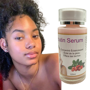 Sbiancamento sierico dissolvenza macchie scure migliora l'assorbimento dei successivi prodotti per la cura della pelle africano bellezza e prodotti per la cura personale - Product Image 1