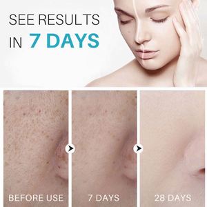 Etiqueta Kojic Cúrcuma Eliminación efectiva Removedor de manchas oscuras Suero facial para desvanecer Manchas oscuras Blanqueamiento Suero de arroz blanco