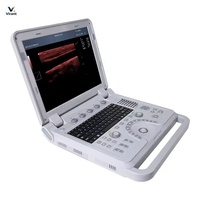 Stabiler digitaler Doppler-Ultraschall mit Akku für Tierkliniken – für die tägliche Tierträchtigkeitsuntersuchung, Großbestellungen möglich.