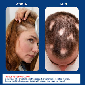 ครีมรักษาศีรษะล้าน bittersweet ครีมบำรุงผิวศีรษะดูแลเส้นผม - Product Image 4