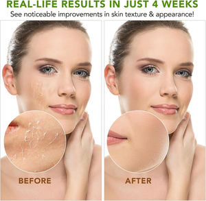 Manteca de Karité 100% Pura, Natural, Sin Refinar, Grado Cosmético, Marca Privada, para Hidratación Diaria, Cuidado de la Piel, Cabello y Cuerpo - Product Image 3